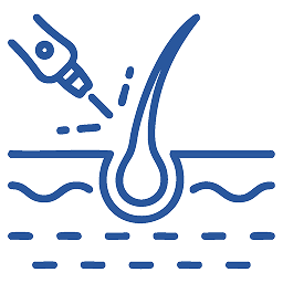 LASER Therapy for Hair